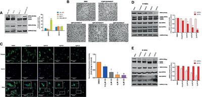 Actin Modulation Regulates the Alpha-1-Syntrophin/p66Shc Mediated Redox Signaling Contributing to the RhoA GTPase Protein Activation in Breast Cancer Cells